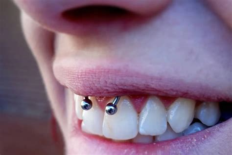 how long does a smiley piercing last|The Smiley Piercing: Pain Level, Aftercare, and Jewelry